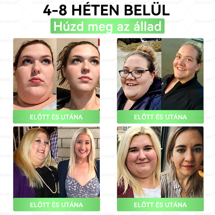 đHivatalos ĂĄruhĂĄz | BuildLeaf GLP-1 20 az 1-ben KarcsĂșsĂtĂł Ă©s egĂ©szsĂ©ges szĂĄjon ĂĄt szedhetĆ folyadĂ©k (naponta egyszer, 7 napon belĂŒl hat) â
TĂĄmogatja a testsĂșlyt Ă©s a nĆk egĂ©szsĂ©gĂ©t, miközben feszesĂti a bĆrt Ă©s fokozza a vitalitĂĄst