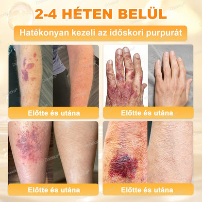 💛Dooeka® 𝟖-𝐈𝐧-𝟏 Méhméreg & Tallow Bőrfirmító és Regeneráló Krém(7 napon belül hatékony) Méhméreg + Tallow · 7X Mélyhidratálás, célozza meg a ráncokat, megereszkedést, striákat, sötét foltokat, purpurát, gyulladásokat és még sok mást.