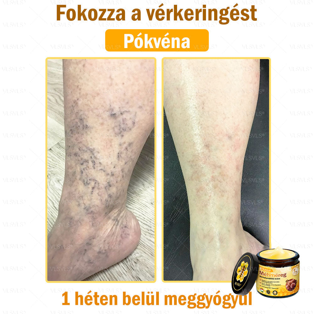 ✨✨💪VLSVLS® Méhméreg Bőrhelyreállító Krém (👨‍⚕‍CE jóváhagyott)👍✅