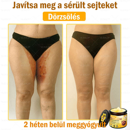 ✨✨💪VLSVLS® Méhméreg Bőrhelyreállító Krém (👨‍⚕‍CE jóváhagyott)👍✅