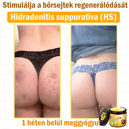 ✨✨💪VLSVLS® Méhméreg Bőrhelyreállító Krém (👨‍⚕‍CE jóváhagyott)👍✅