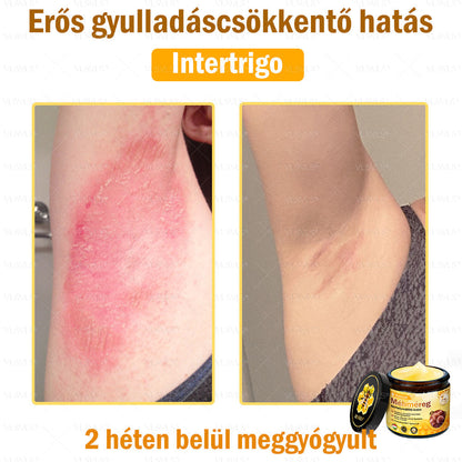 ✨✨💪VLSVLS® Méhméreg Bőrhelyreállító Krém (👨‍⚕‍CE jóváhagyott)👍✅