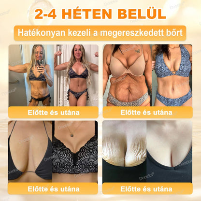 💛Dooeka® 𝟖-𝐈𝐧-𝟏 Méhméreg & Tallow Bőrfirmító és Regeneráló Krém(7 napon belül hatékony) Méhméreg + Tallow · 7X Mélyhidratálás, célozza meg a ráncokat, megereszkedést, striákat, sötét foltokat, purpurát, gyulladásokat és még sok mást.