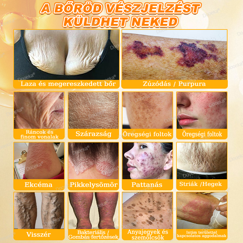💛Dooeka® 𝟖-𝐈𝐧-𝟏 Méhméreg & Tallow Bőrfirmító és Regeneráló Krém(7 napon belül hatékony) Méhméreg + Tallow · 7X Mélyhidratálás, célozza meg a ráncokat, megereszkedést, striákat, sötét foltokat, purpurát, gyulladásokat és még sok mást.