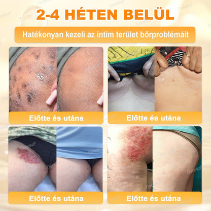 💛Dooeka® 𝟖-𝐈𝐧-𝟏 Méhméreg & Tallow Bőrfirmító és Regeneráló Krém(7 napon belül hatékony) Méhméreg + Tallow · 7X Mélyhidratálás, célozza meg a ráncokat, megereszkedést, striákat, sötét foltokat, purpurát, gyulladásokat és még sok mást.