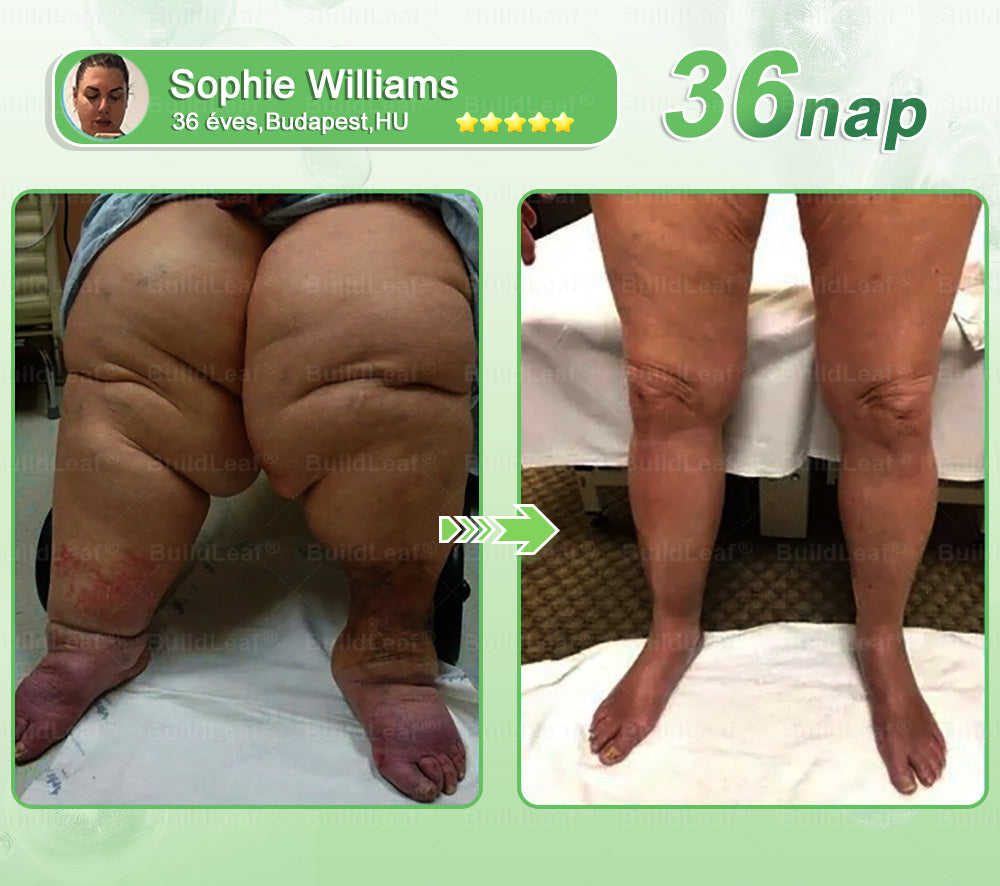 BuildLeaf®🚚 GLP-1 8-az-1-ben Fit &amp; Vital Orális Oldat (Csak napi egyszer, látható változások 7 nap alatt)  Elhízásra, szív- és érrendszeri egészségre, cukorbetegségre, alvási apnoéra, emésztőrendszeri egészségre, ízületi problémákra és még sok másra