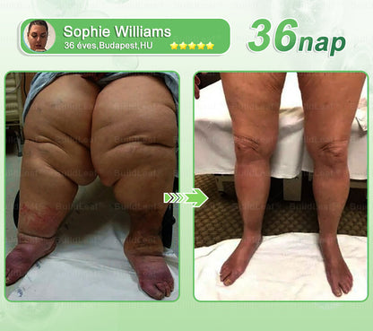 BuildLeaf®🚚 GLP-1 8-az-1-ben Fit &amp; Vital Orális Oldat (Csak napi egyszer, látható változások 7 nap alatt)  Elhízásra, szív- és érrendszeri egészségre, cukorbetegségre, alvási apnoéra, emésztőrendszeri egészségre, ízületi problémákra és még sok másra