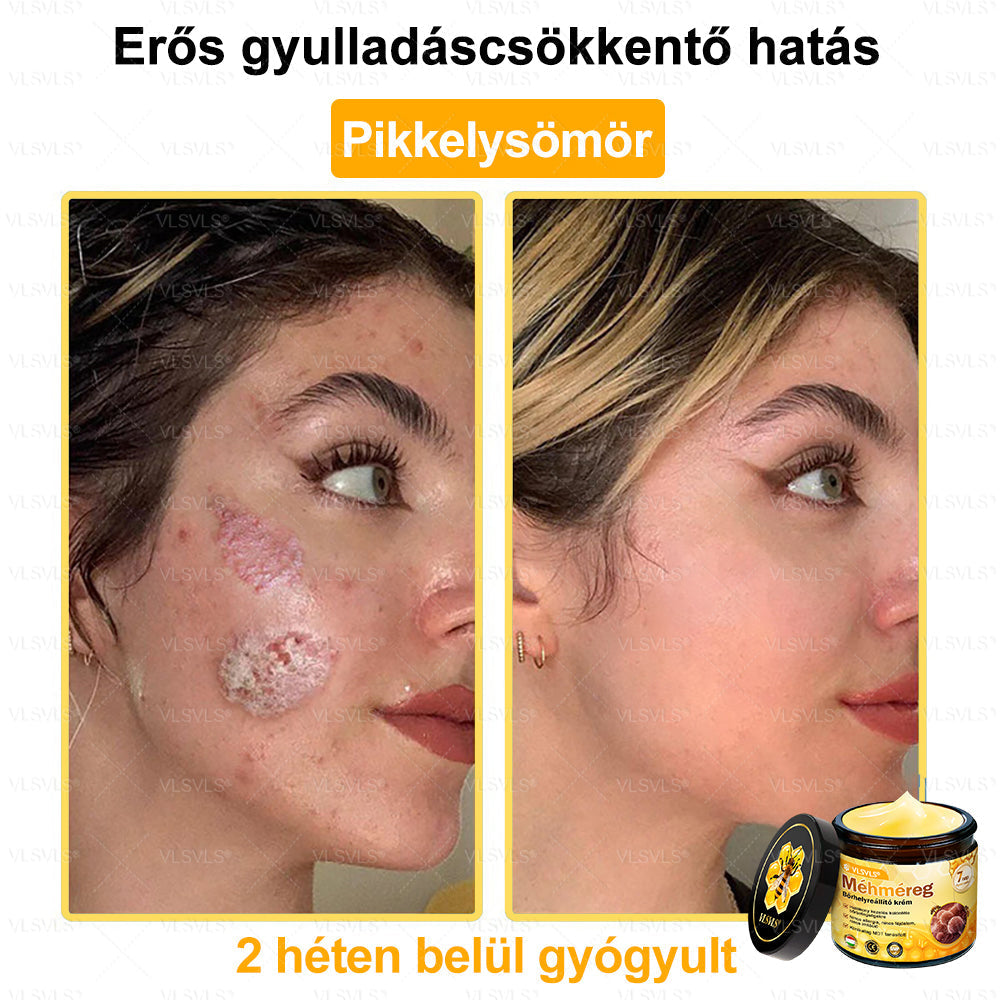 ✨✨💪VLSVLS® Méhméreg Bőrhelyreállító Krém (👨‍⚕‍CE jóváhagyott)👍✅