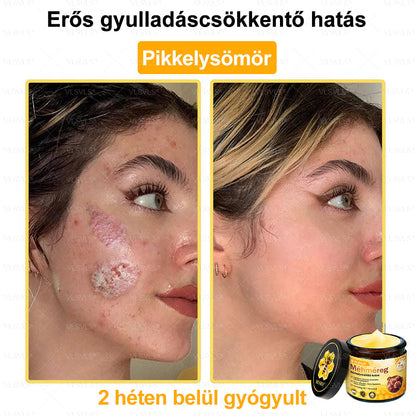 ✨✨💪VLSVLS® Méhméreg Bőrhelyreállító Krém (👨‍⚕‍CE jóváhagyott)👍✅