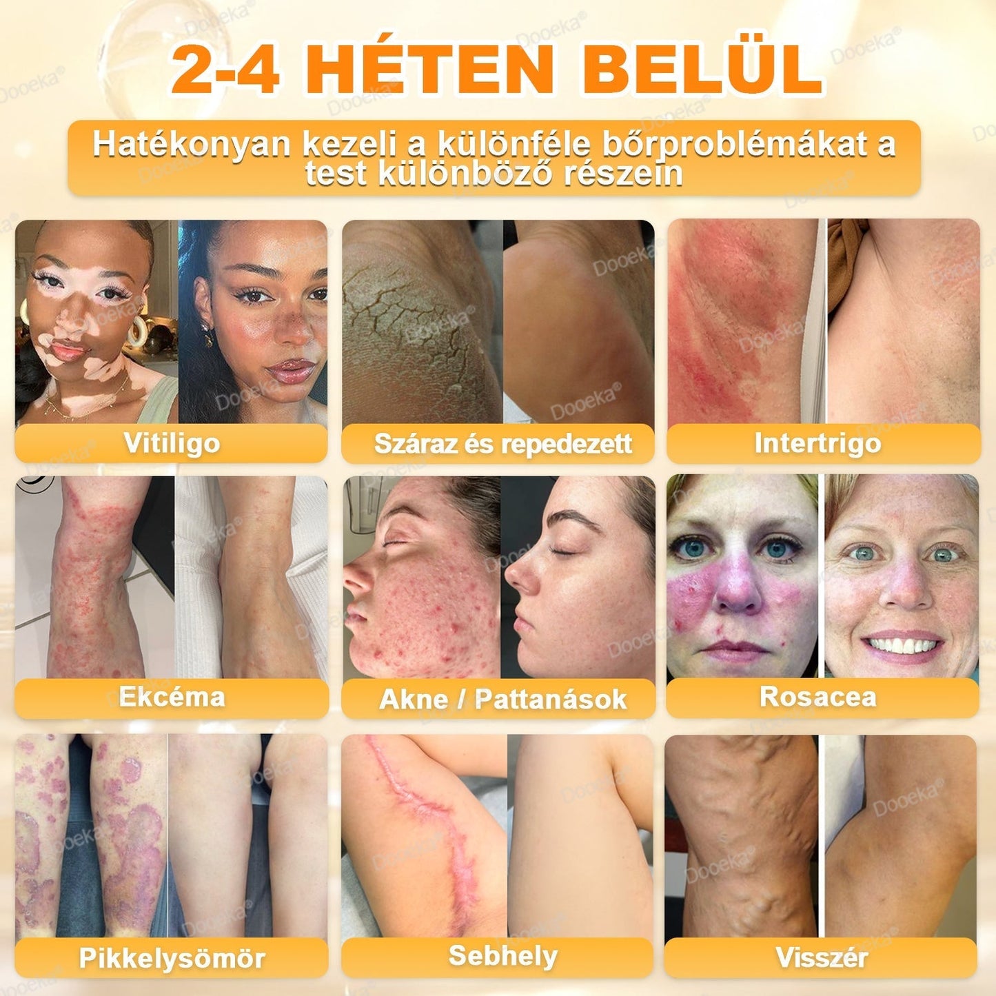 💛Dooeka® 𝟖-𝐈𝐧-𝟏 Méhméreg & Tallow Bőrfirmító és Regeneráló Krém(7 napon belül hatékony) Méhméreg + Tallow · 7X Mélyhidratálás, célozza meg a ráncokat, megereszkedést, striákat, sötét foltokat, purpurát, gyulladásokat és még sok mást.
