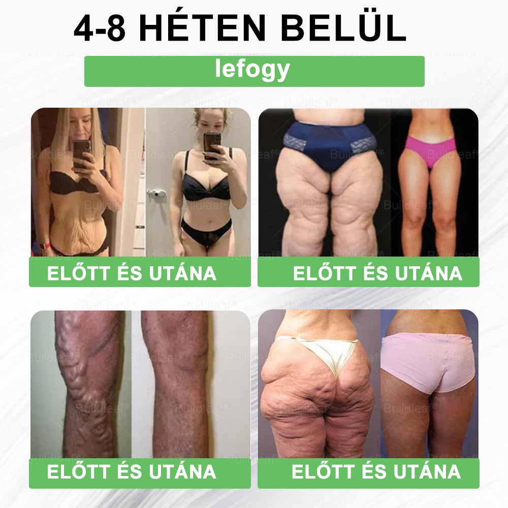 BuildLeaf®🚚 GLP-1 8-az-1-ben Fit &amp; Vital Orális Oldat (Csak napi egyszer, látható változások 7 nap alatt)  Elhízásra, szív- és érrendszeri egészségre, cukorbetegségre, alvási apnoéra, emésztőrendszeri egészségre, ízületi problémákra és még sok másra