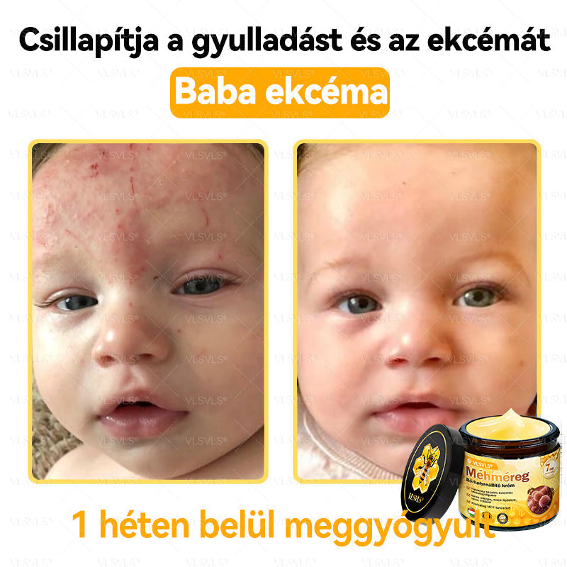 ✨✨💪VLSVLS® Méhméreg Bőrhelyreállító Krém (👨‍⚕‍CE jóváhagyott)👍✅