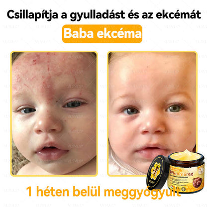 ✨✨💪VLSVLS® Méhméreg Bőrhelyreállító Krém (👨‍⚕‍CE jóváhagyott)👍✅