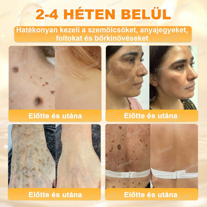 💛Dooeka® 𝟖-𝐈𝐧-𝟏 Méhméreg & Tallow Bőrfirmító és Regeneráló Krém(7 napon belül hatékony) Méhméreg + Tallow · 7X Mélyhidratálás, célozza meg a ráncokat, megereszkedést, striákat, sötét foltokat, purpurát, gyulladásokat és még sok mást.