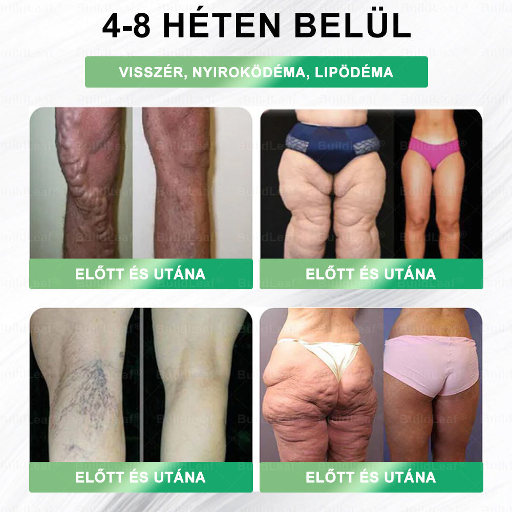 BuildLeaf®🚚 GLP-1 8-az-1-ben Fit &amp; Vital Orális Oldat (Csak napi egyszer, látható változások 7 nap alatt)  Elhízásra, szív- és érrendszeri egészségre, cukorbetegségre, alvási apnoéra, emésztőrendszeri egészségre, ízületi problémákra és még sok másra