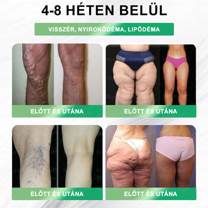 BuildLeaf®🚚 GLP-1 8-az-1-ben Fit &amp; Vital Orális Oldat (Csak napi egyszer, látható változások 7 nap alatt)  Elhízásra, szív- és érrendszeri egészségre, cukorbetegségre, alvási apnoéra, emésztőrendszeri egészségre, ízületi problémákra és még sok másra