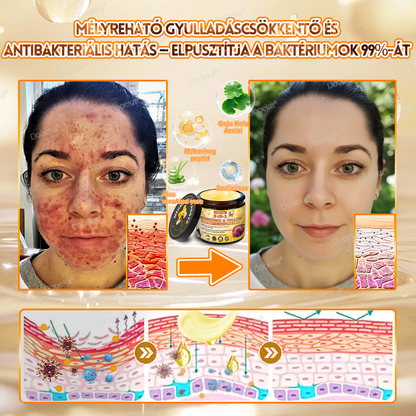 💛Dooeka® 𝟖-𝐈𝐧-𝟏 Méhméreg & Tallow Bőrfirmító és Regeneráló Krém(7 napon belül hatékony) Méhméreg + Tallow · 7X Mélyhidratálás, célozza meg a ráncokat, megereszkedést, striákat, sötét foltokat, purpurát, gyulladásokat és még sok mást.