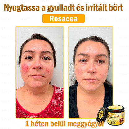 ✨✨💪VLSVLS® Méhméreg Bőrhelyreállító Krém (👨‍⚕‍CE jóváhagyott)👍✅