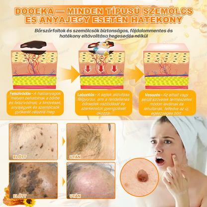 💛Dooeka® 𝟖-𝐈𝐧-𝟏 Méhméreg & Tallow Bőrfirmító és Regeneráló Krém(7 napon belül hatékony) Méhméreg + Tallow · 7X Mélyhidratálás, célozza meg a ráncokat, megereszkedést, striákat, sötét foltokat, purpurát, gyulladásokat és még sok mást.