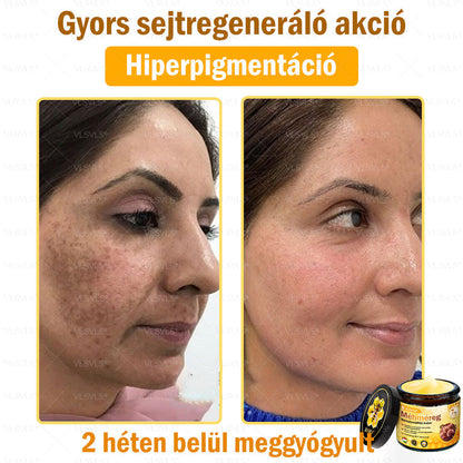 ✨✨💪VLSVLS® Méhméreg Bőrhelyreállító Krém (👨‍⚕‍CE jóváhagyott)👍✅
